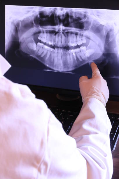 Best Knocked-Out Tooth Emergency  in Port Allen, LA