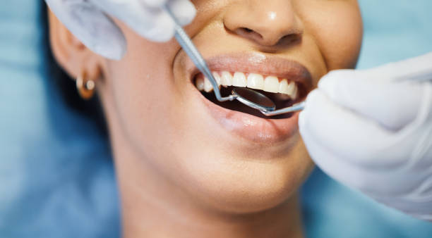 Best Knocked-Out Tooth Emergency  in Port Allen, LA