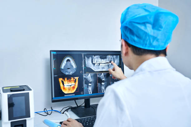 Best Chipped Tooth Repair Near Me  in Port Allen, LA